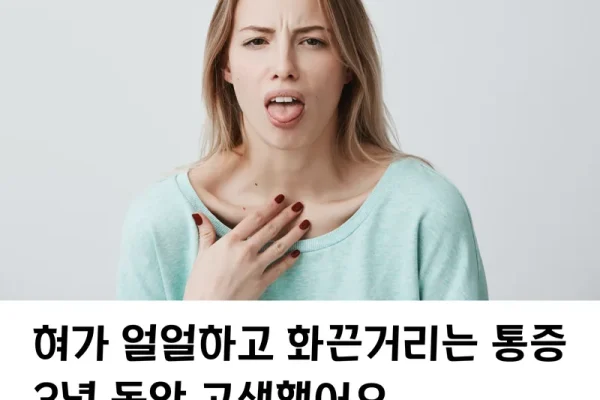 혀가 화끈거리고 아픈 느낌, 겪어보셨나요? (구강작열감 증상과 내돈내산 닥터프렌드 2달 사용 후기)